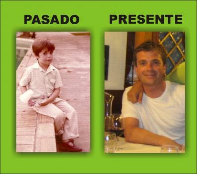 Before & After (Jose Antonio)